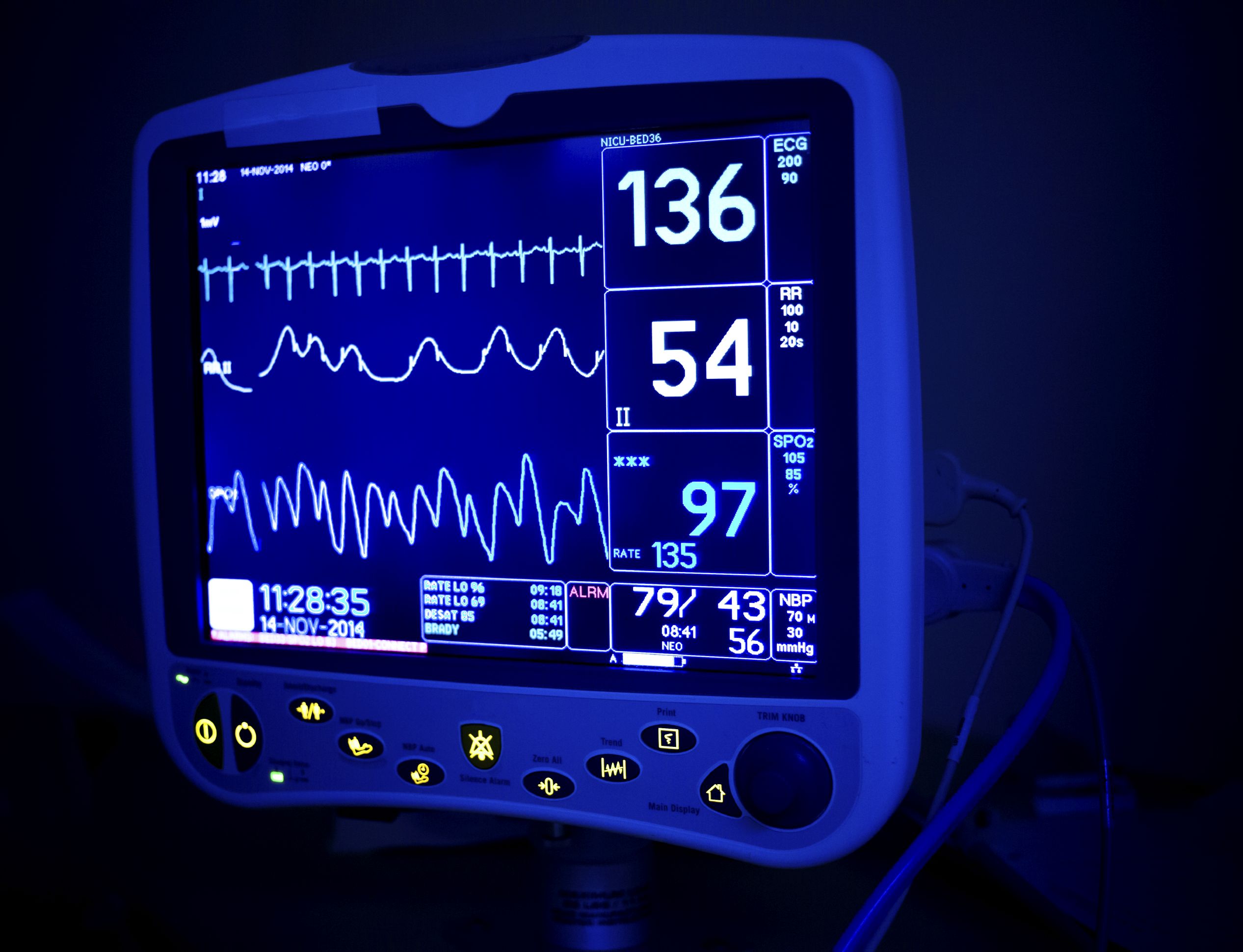 Universal Electronics, Inc. Box Build Assembly